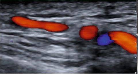 MJ2403: 3rd North American Workshop on Ultrasound in Large Vessel Vasculitis Banner